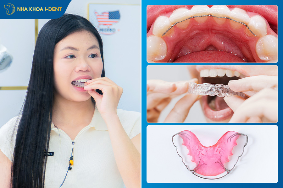 quy trình niềng răng mắc cài