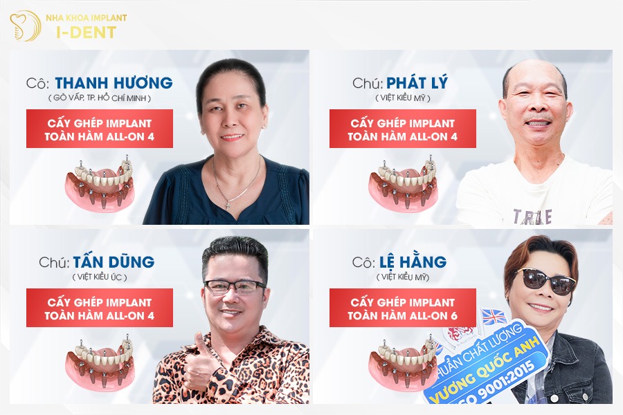 trồng răng bằng cấy ghép implant