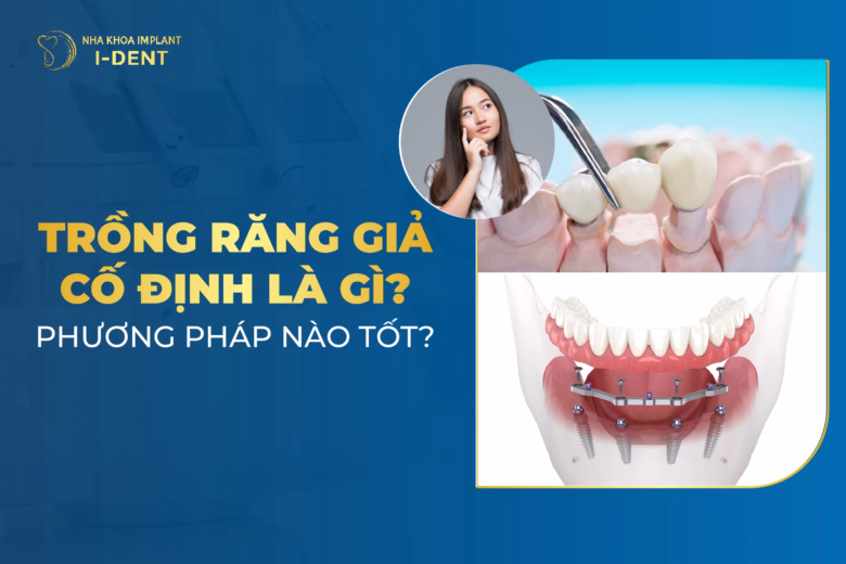 Trồng răng giả cố định là gì? Phương pháp nào tốt?