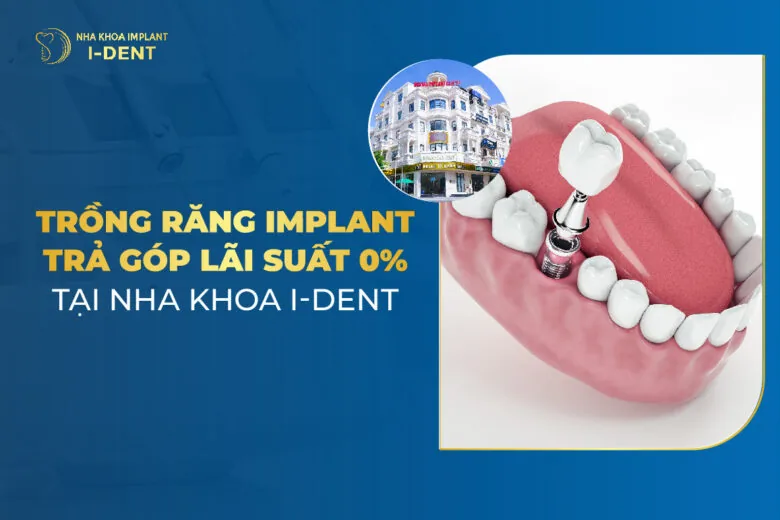 trồng răng implant trả góp