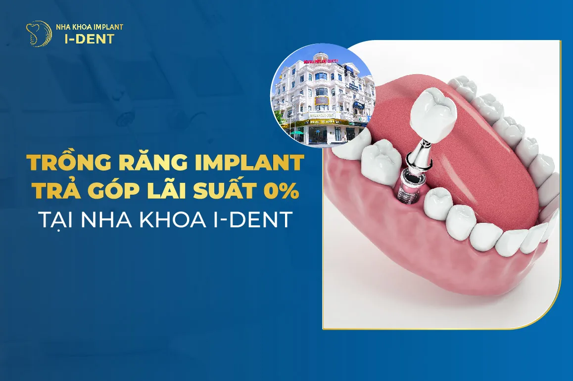 trồng răng implant trả góp