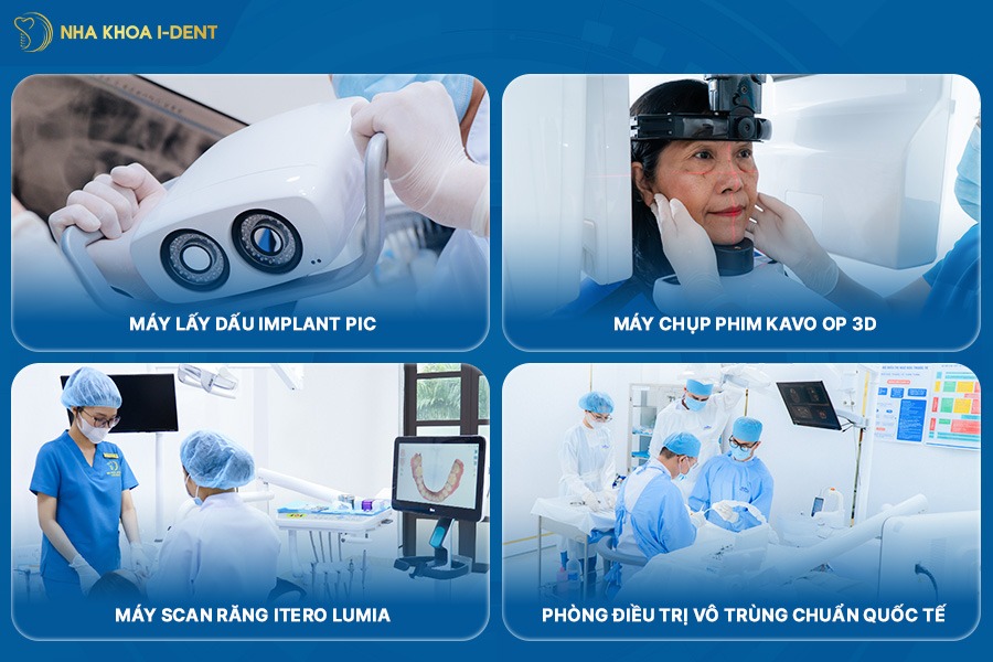 cấy ghép implant tại tphcm