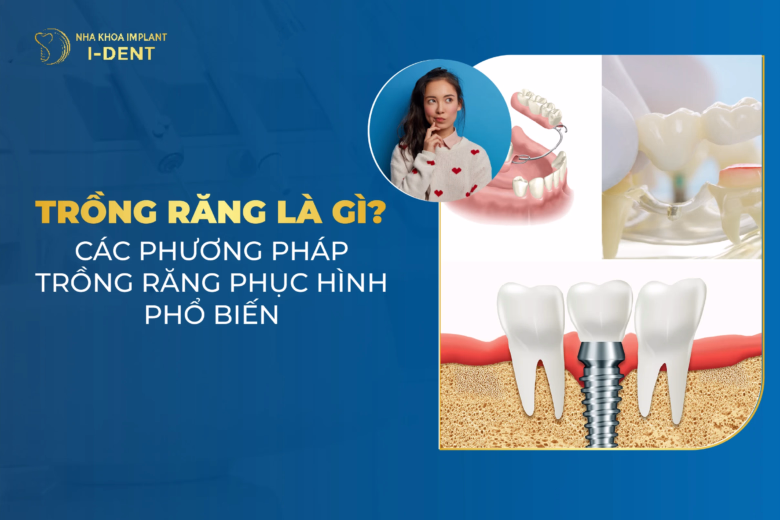 trồng răng là gì các phương pháp trồng răng phục hình phổ biến