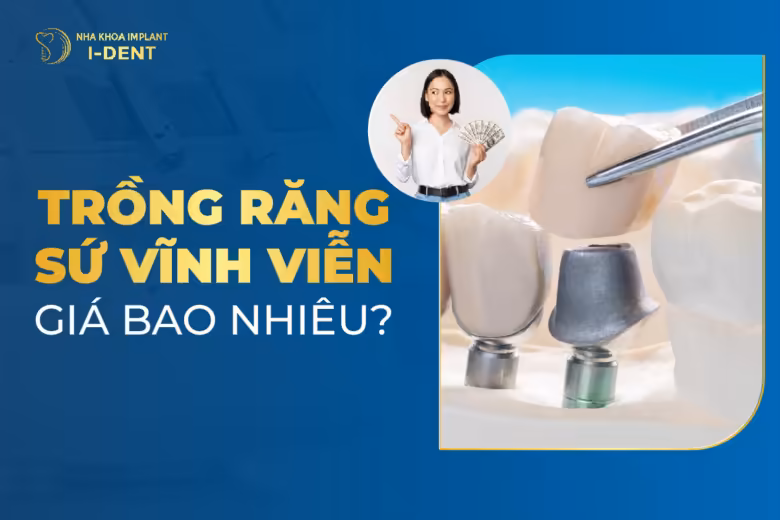 trồng răng sứ vĩnh viễn giá bao nhiêu