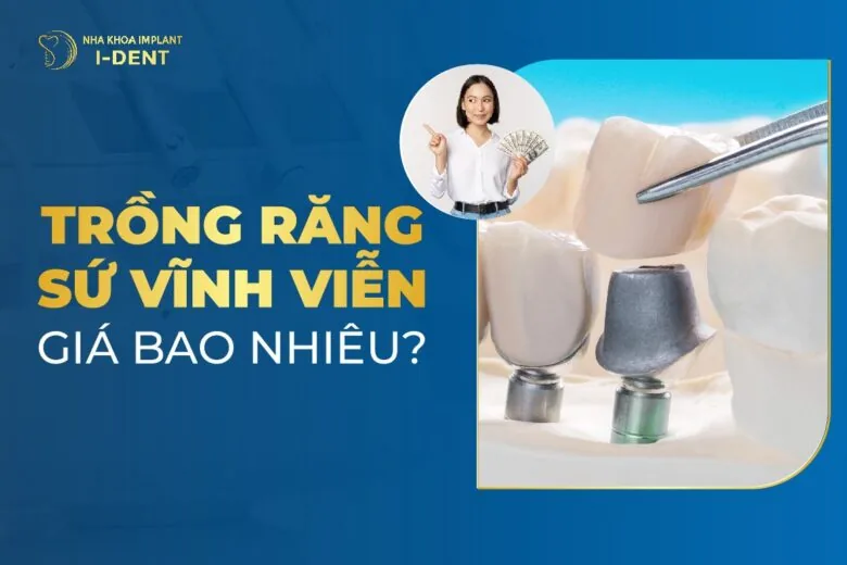 trồng răng sứ vĩnh viễn giá bao nhiêu