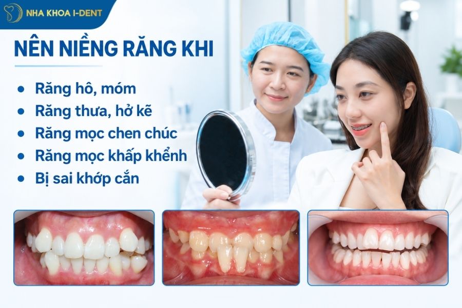khi nào cần niềng răng