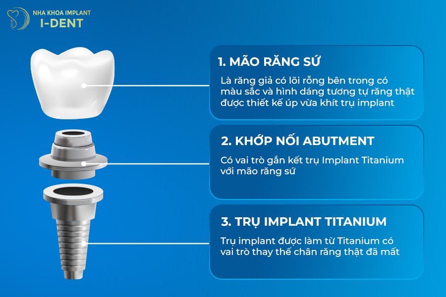 giá trồng răng implant