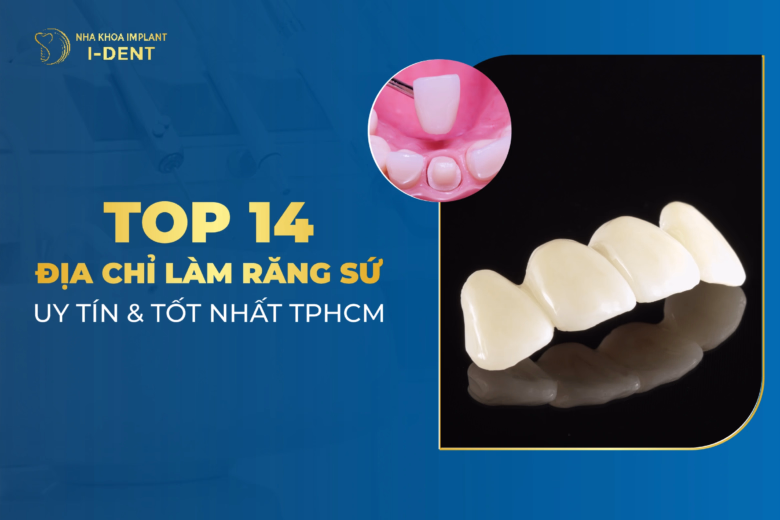 Top 14 Địa Chỉ Nha Khoa Làm Răng Sứ Uy Tín Nhất TPHCM