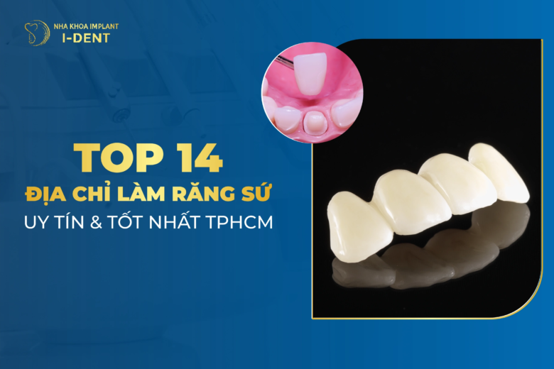 Top 14 Địa Chỉ Nha Khoa Làm Răng Sứ Uy Tín Nhất TPHCM