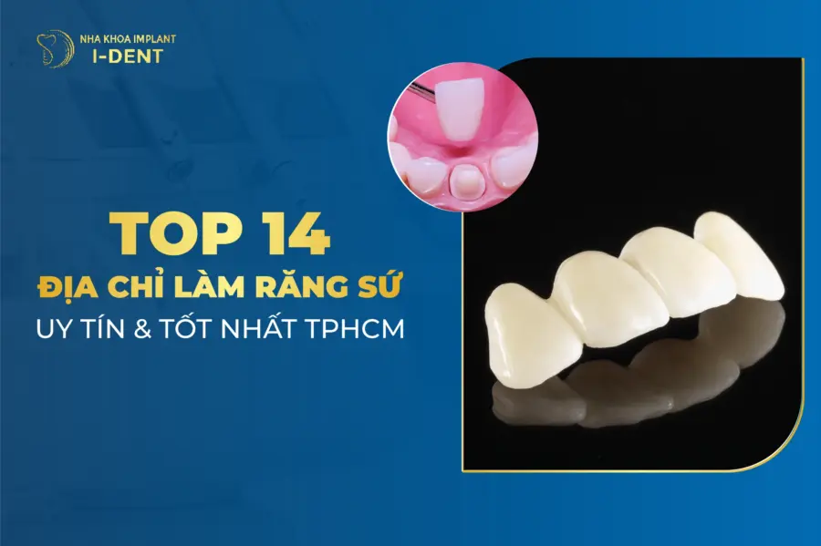 NHA KHOA HÀ NỘI VỚI ĐỘI NGŨ BÁC SĨ CHUYÊN MÔN CAO
