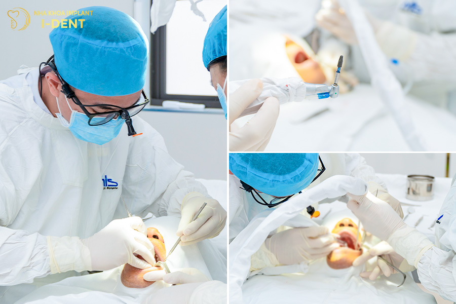cắm implant giá