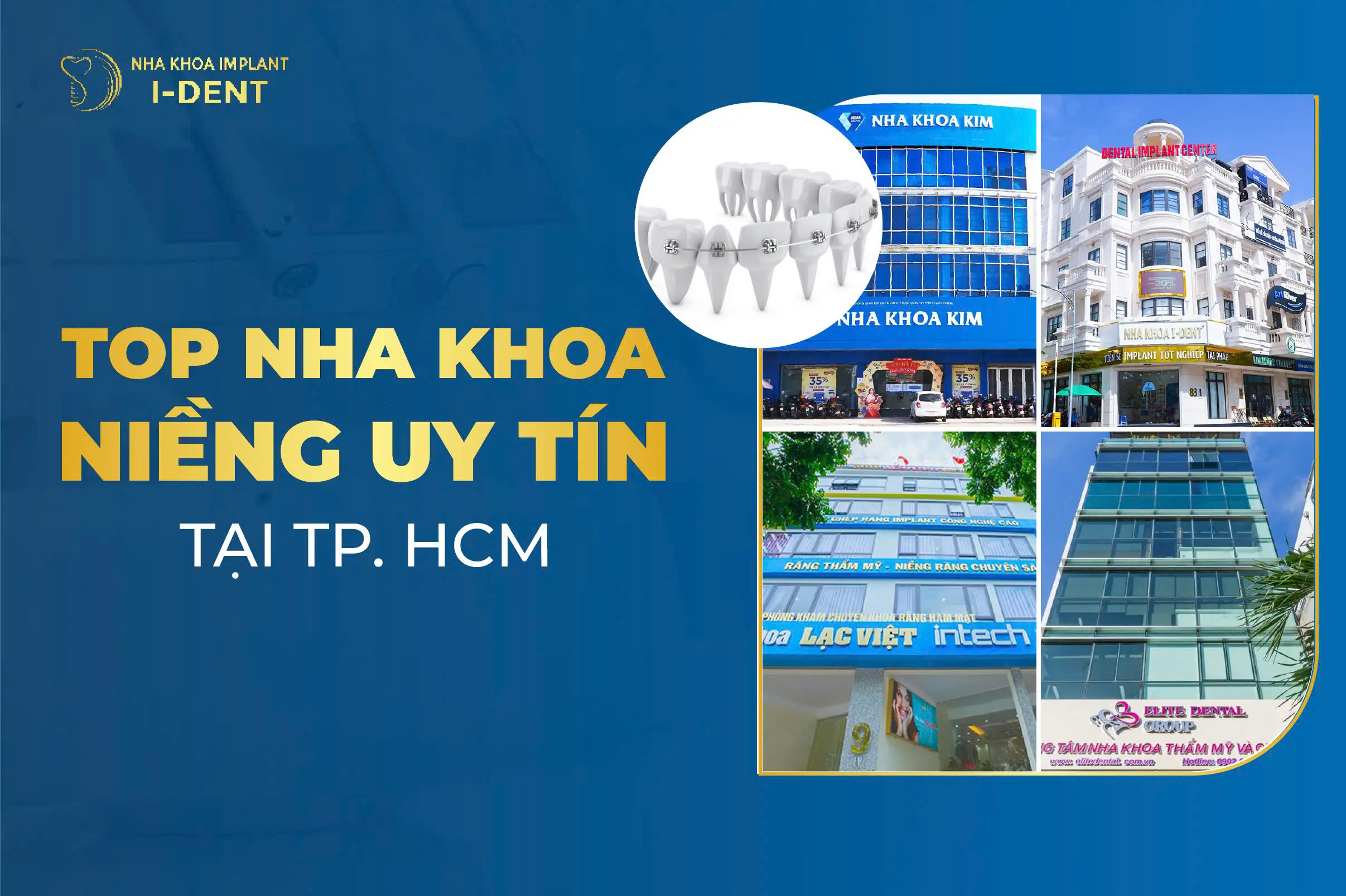 Top 10 nha khoa niềng răng uy tín tại TP.HCM