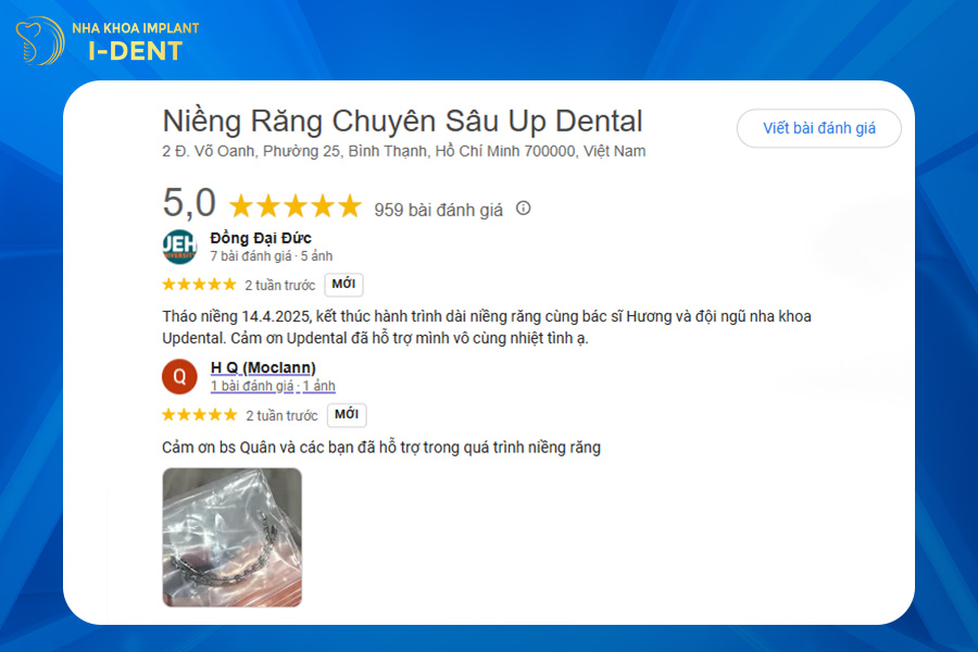 nha khoa niềng răng uy tín tphcm