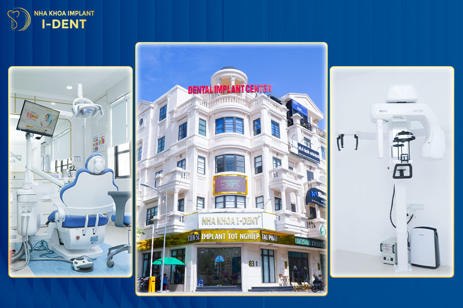 niềng răng ở đâu tốt nhất gò vấp