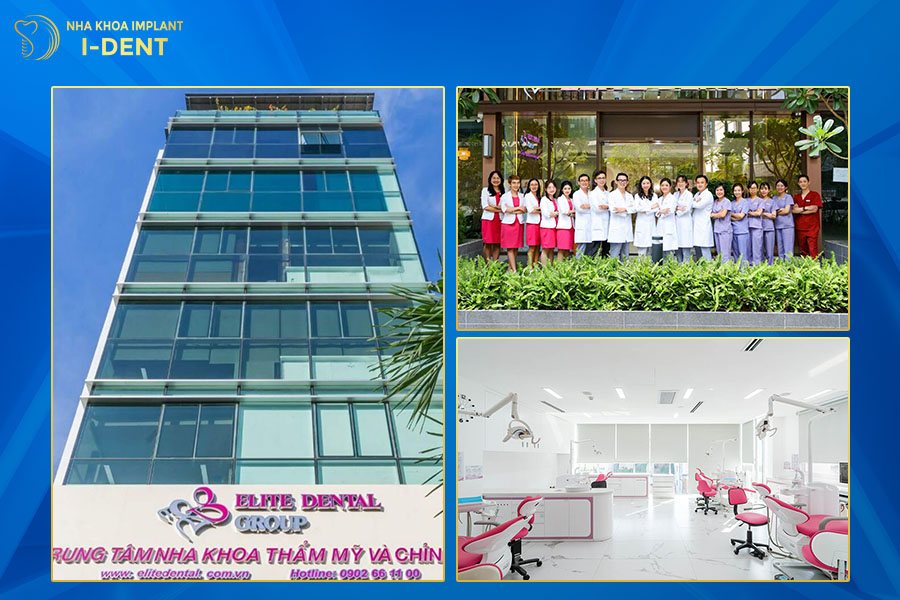 niềng răng ở đâu tốt tại tphcm