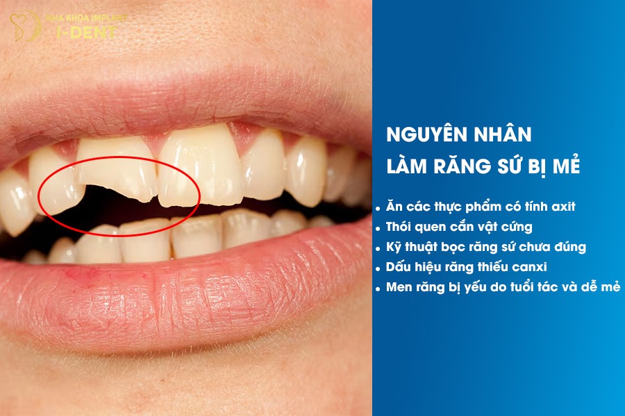 răng sứ có trám được không