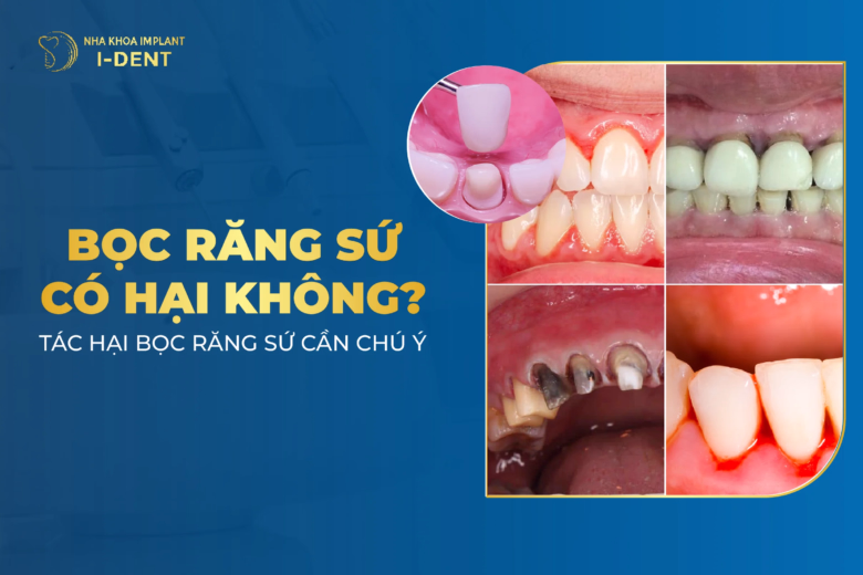 11 Tác Hại Bọc Răng Sứ Cần Lưu Ý Trước Khi Thực Hiện