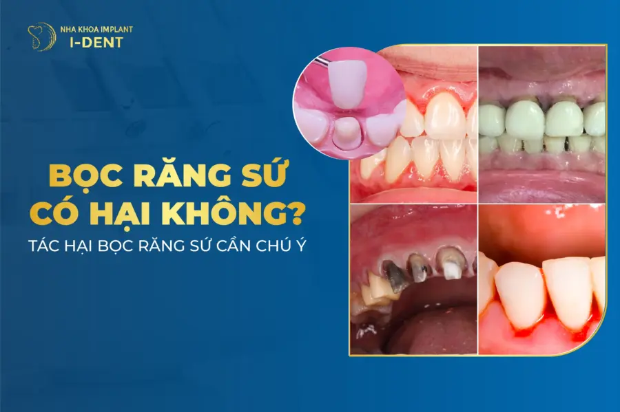 hậu quả bọc răng sứ