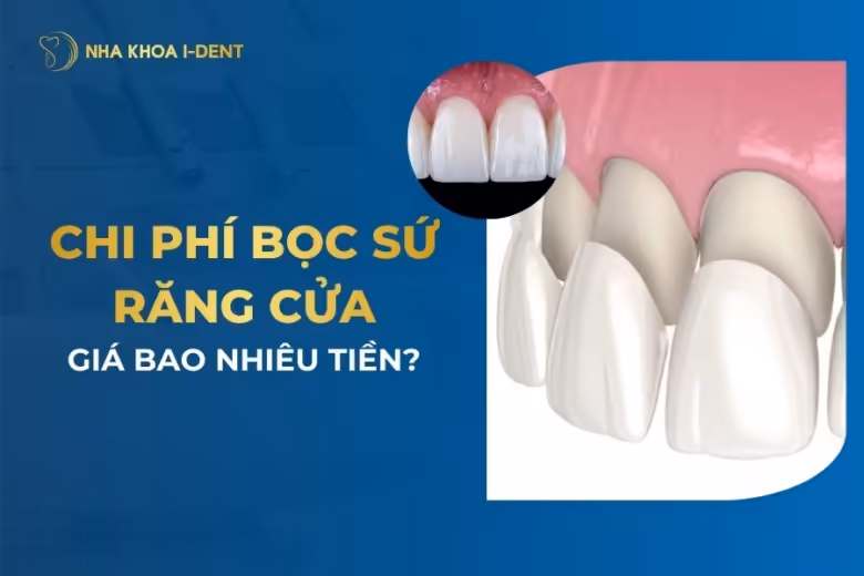 bọc sứ răng cửa