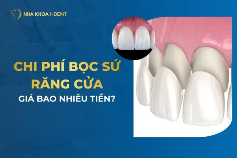 bọc sứ răng cửa
