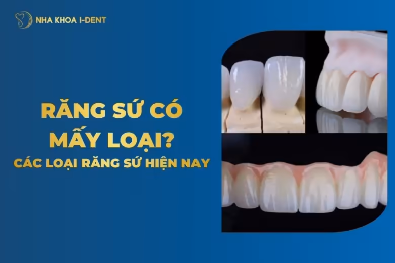 các loại răng sứ