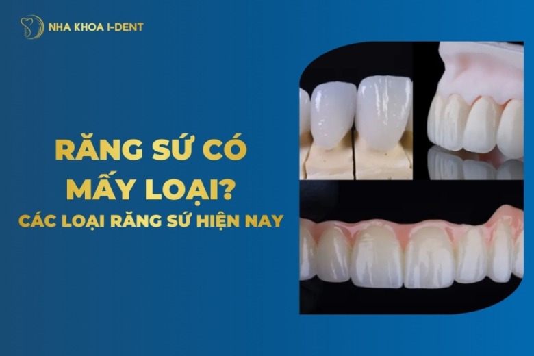 Răng Sứ Có Mấy Loại? Các Loại Răng Sứ Trên Thị Trường