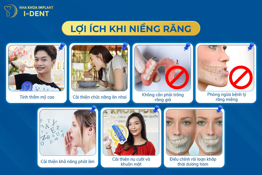 Lợi ích khi thực hiện niềng răng