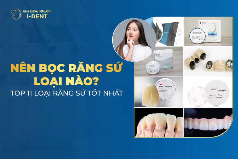 Nên Bọc Răng Sứ Loại Nào? Top 11 Các Loại Răng Sứ Tốt Nhất 2025