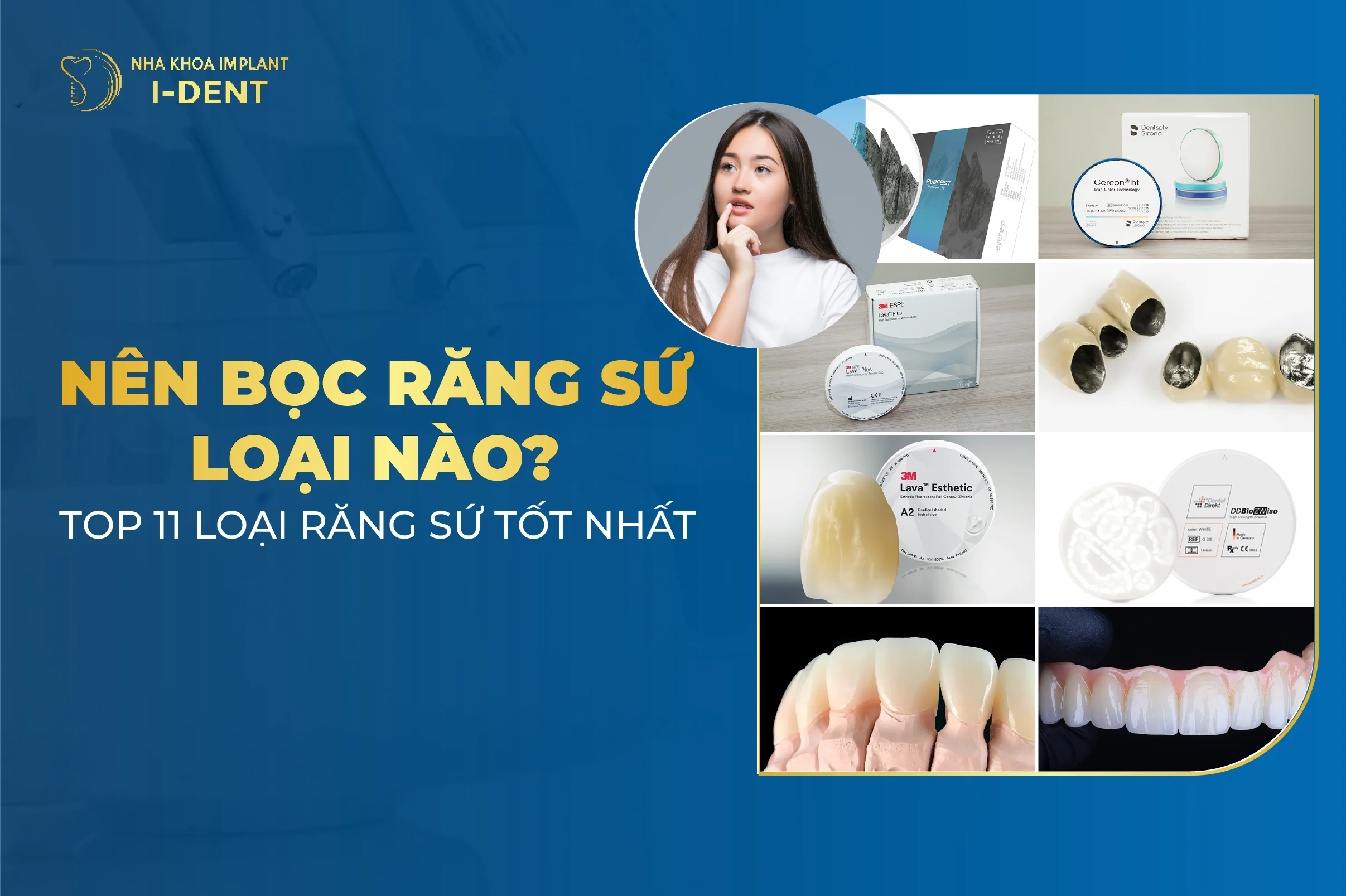 Top 11 Các Loại Răng Sứ Tốt Nhất Hiện Nay 2025