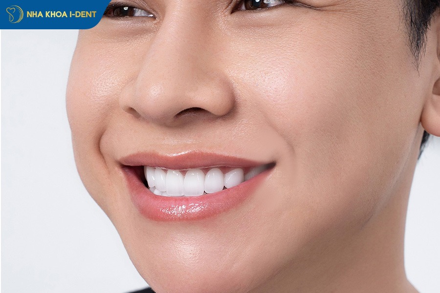 răng sứ kiểu thỏ