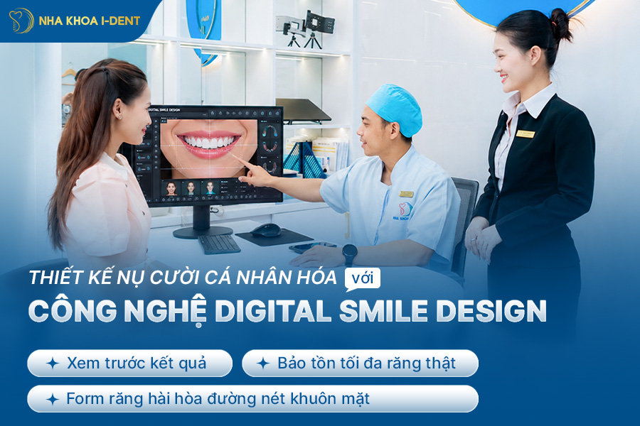 sứ cercon