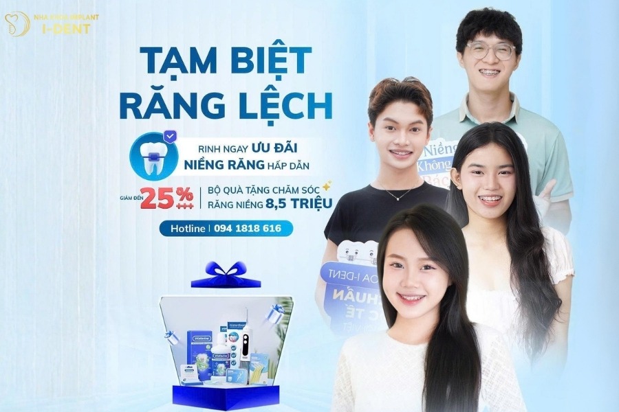 ưu đãi niềng răng