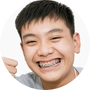 Răng Vĩnh Viễn Mọc Đúng Vị Trí
