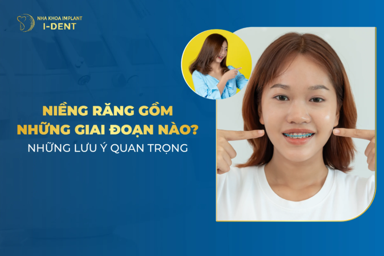 Niềng Răng Gồm Những Giai đoạn Nào? Những Lưu Ý Quan Trọng