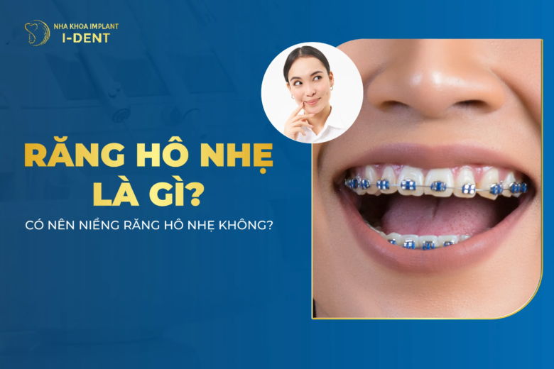 Răng Hô Nhẹ Có Nên Niềng Không? Có Phải Nhổ Răng Không?