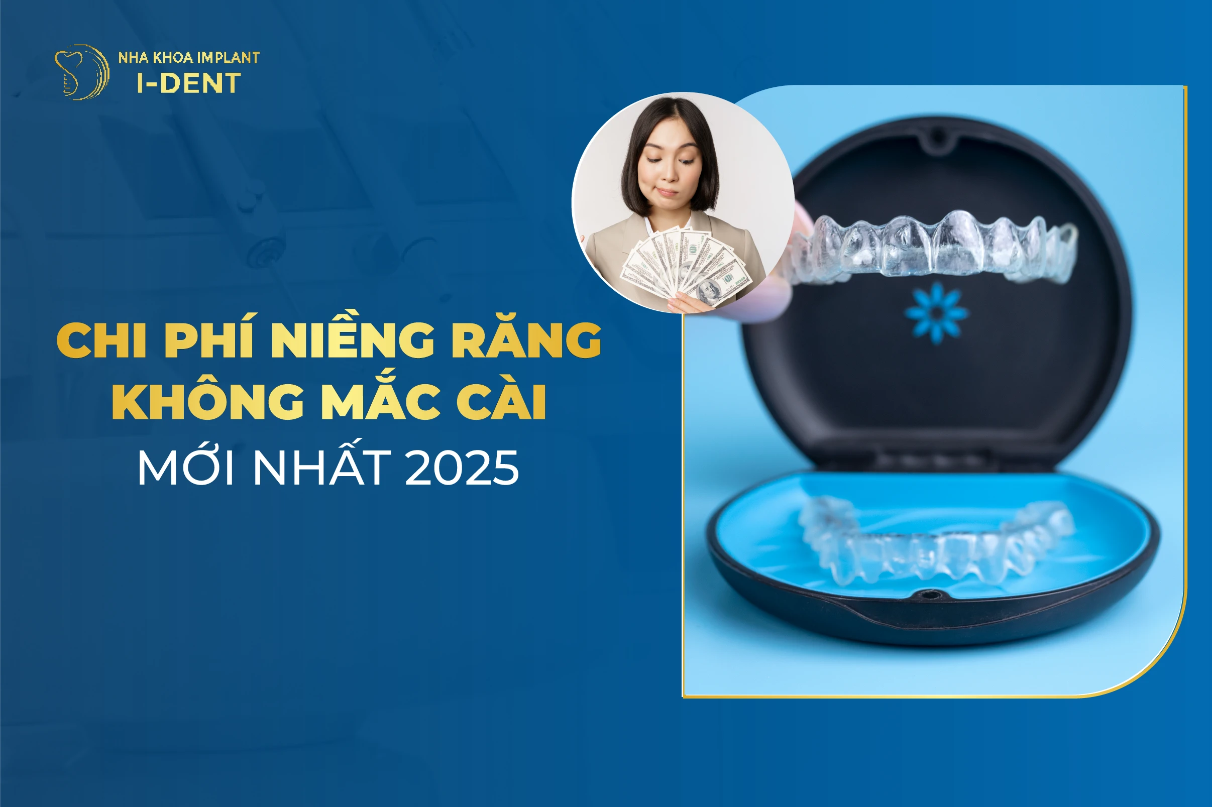 Chi Phí Niềng Răng Không Mắc Cài Mới Nhất 2025