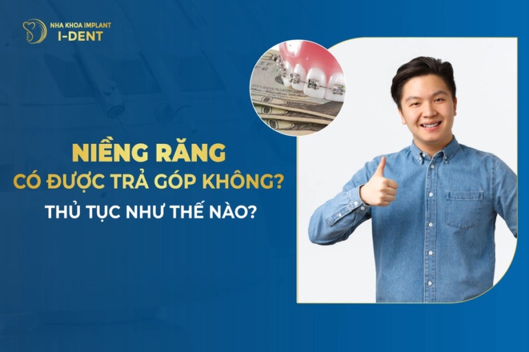 niềng răng trả góp