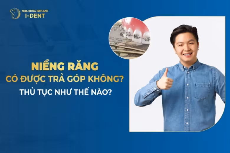 niềng răng trả góp