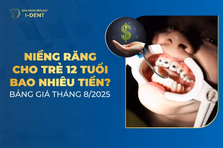 giá niềng răng cho trẻ 12 tuổi