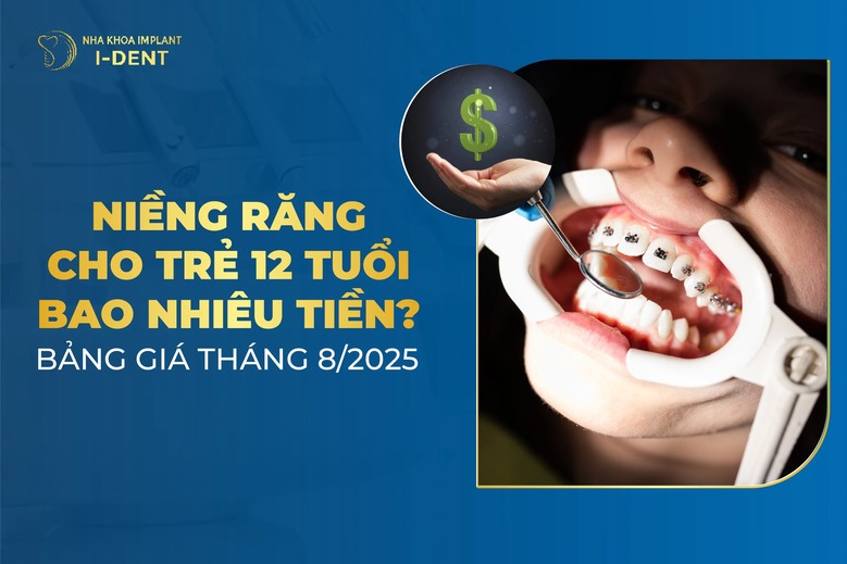 Niềng Răng Cho Trẻ 12 Tuổi Bao Nhiêu Tiền? Bảng Giá 2025