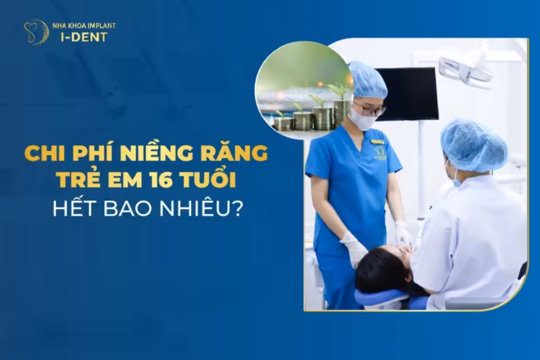 Chi Phí Niềng Răng Trẻ Em 16 Tuổi Hết Bao Nhiêu?
