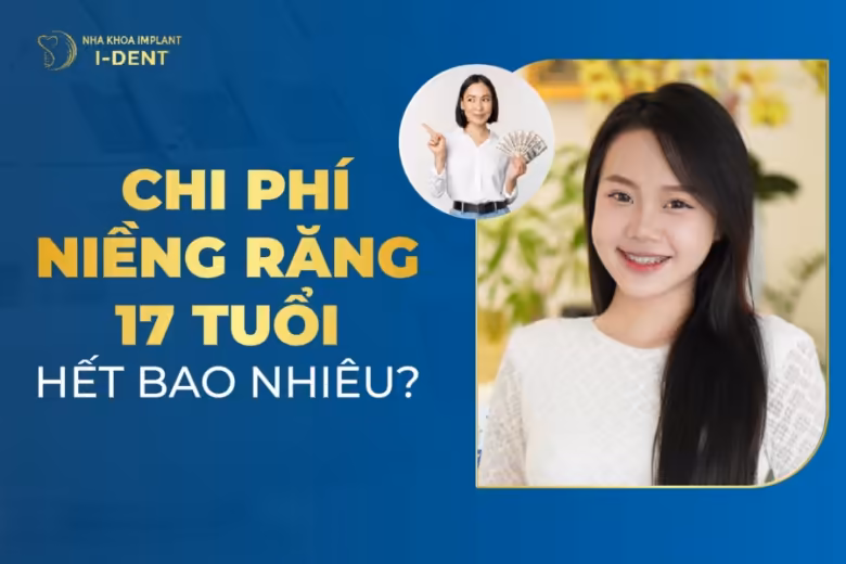 17 tuổi niềng răng bao nhiêu tiền