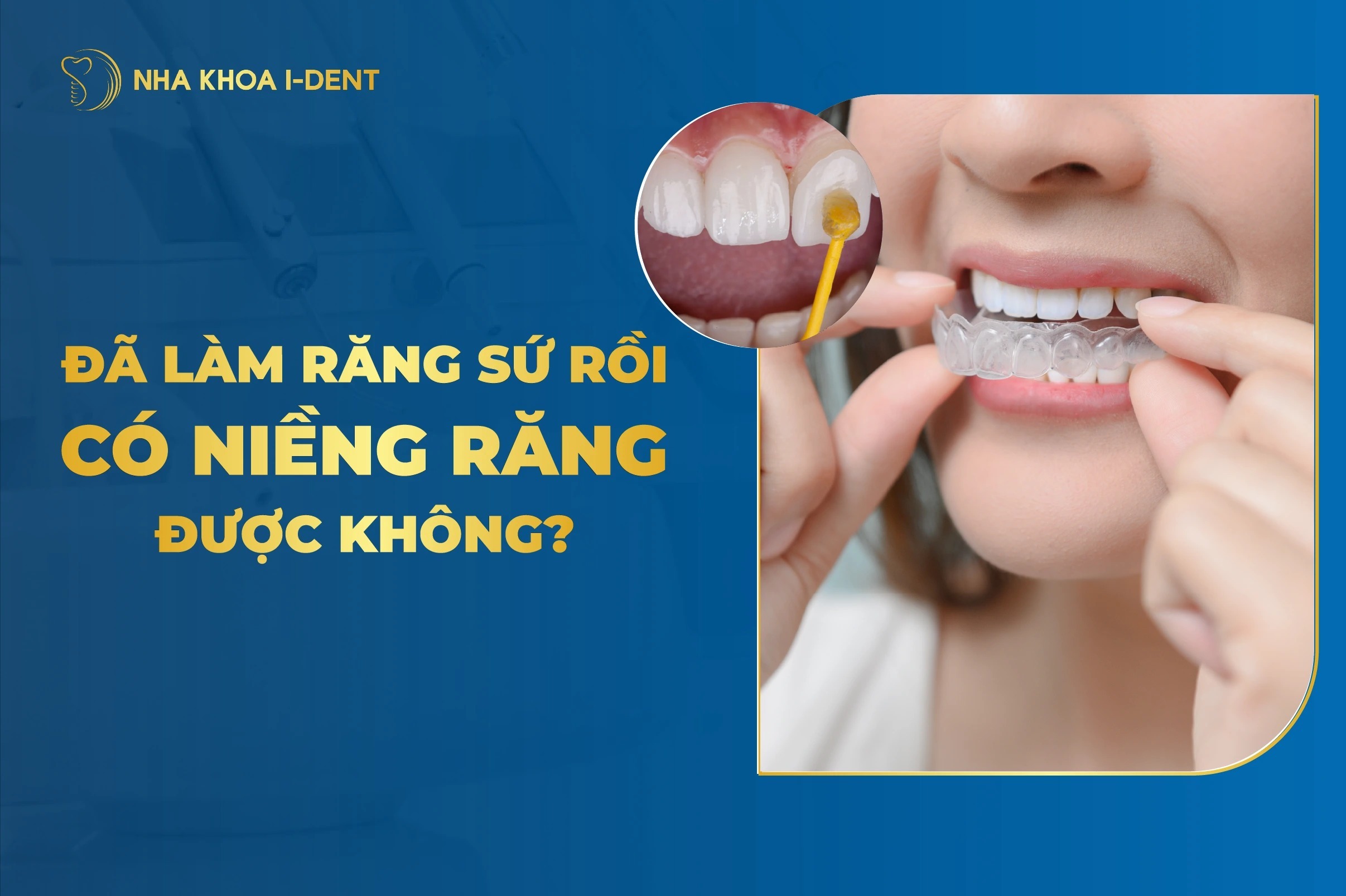 Đã Làm Răng Sứ Rồi Có Niềng Răng Được Không?