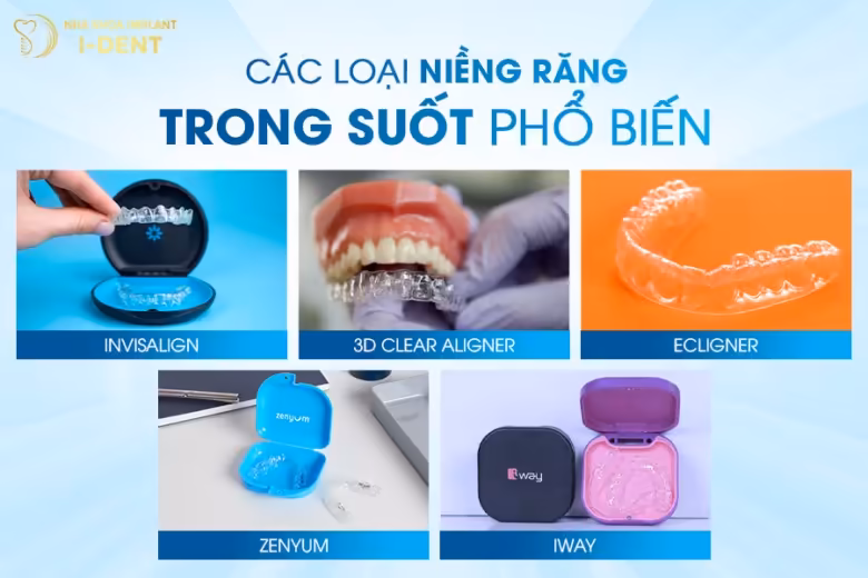 các loại niềng răng trong suốt