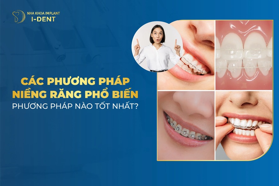 Các Phương Pháp Niềng Răng Tốt Nhất Hiện Nay