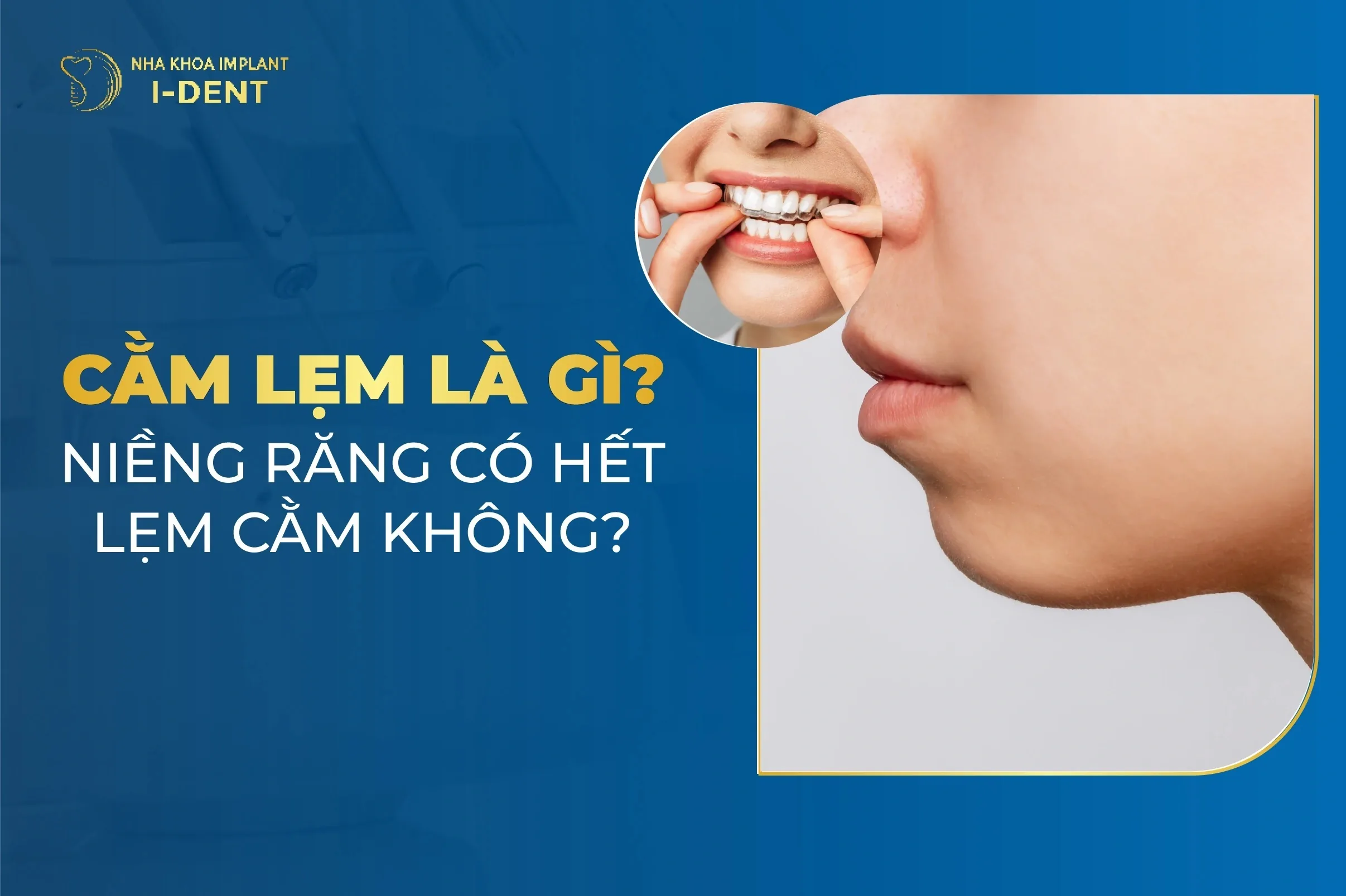 Niềng Răng Có Hết Lẹm Cằm Không? Phương Pháp Thực Hiện