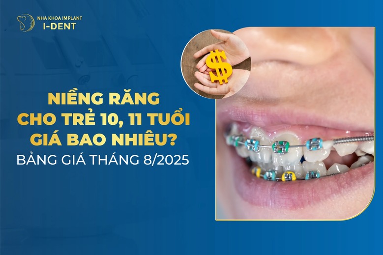 Niềng Răng Cho Trẻ 10, 11 Tuổi Giá Bao Nhiêu? Bảng Giá Tháng 9/2025