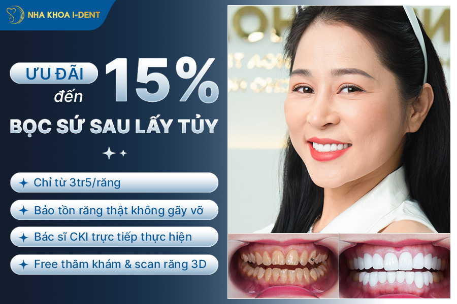 lấy tủy bọc răng sứ giá bao nhiêu