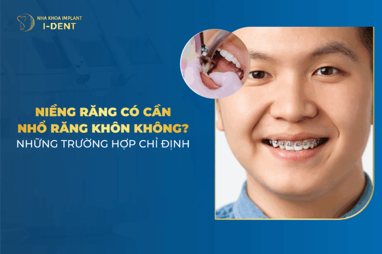 niềng răng có cần nhổ răng khôn không