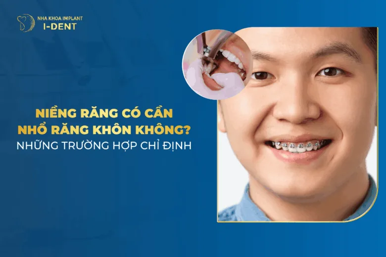 niềng răng có cần nhổ răng khôn không